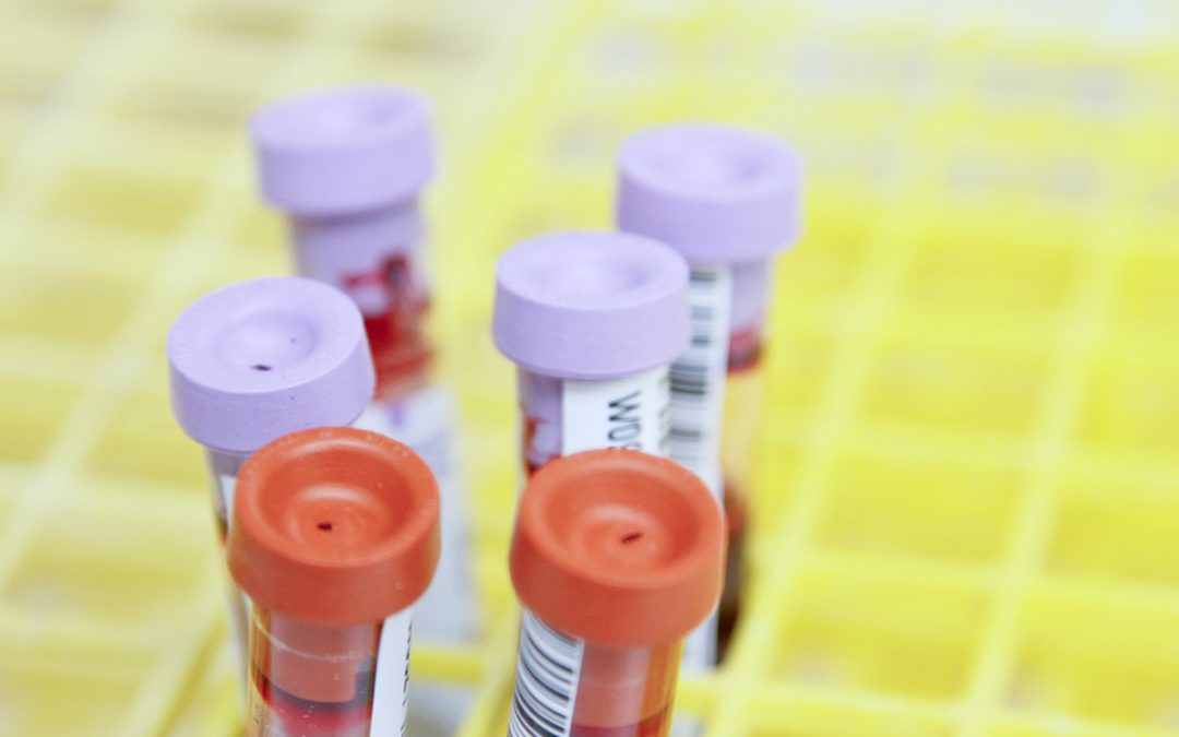 HIV: The Other Epidemic